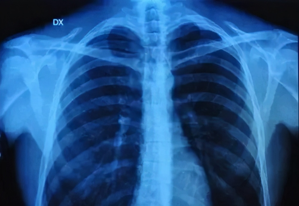 体检哪些项目不值得做,这些体检项目套路深别花冤枉钱