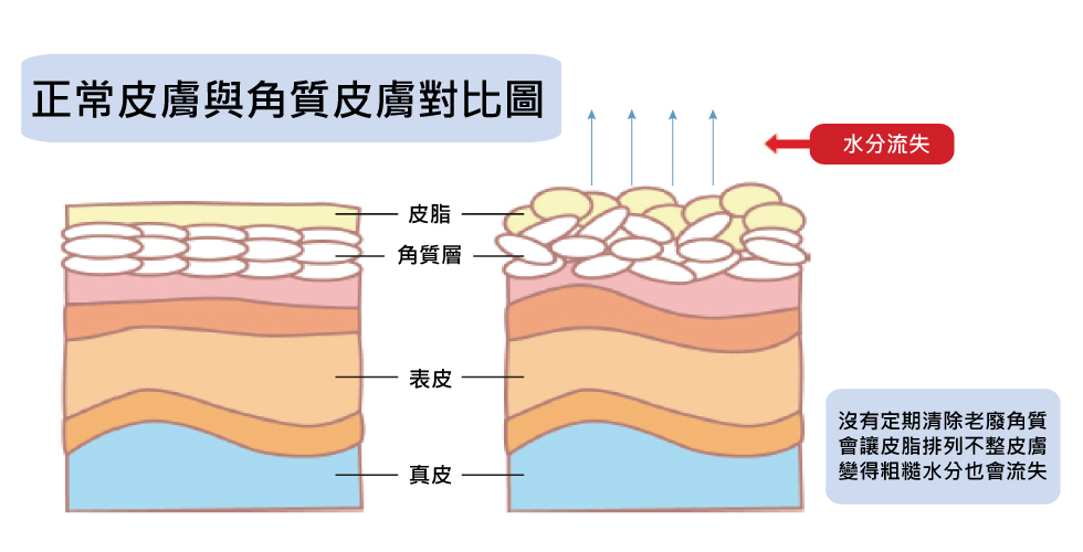 干皮抗老如何进阶手把手教你搭配,干皮怎么抗老