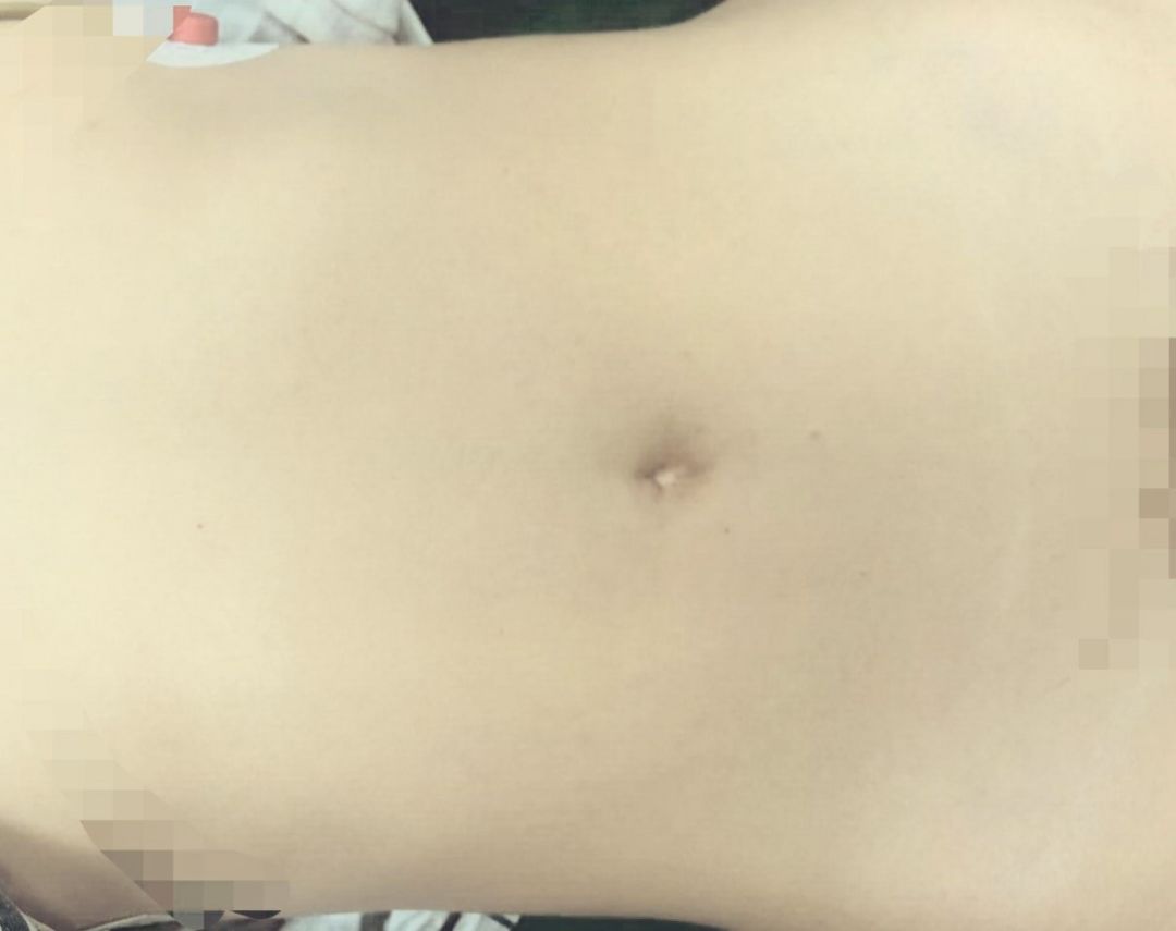 妇产科新技术怎么做,妇产科诊疗新技术