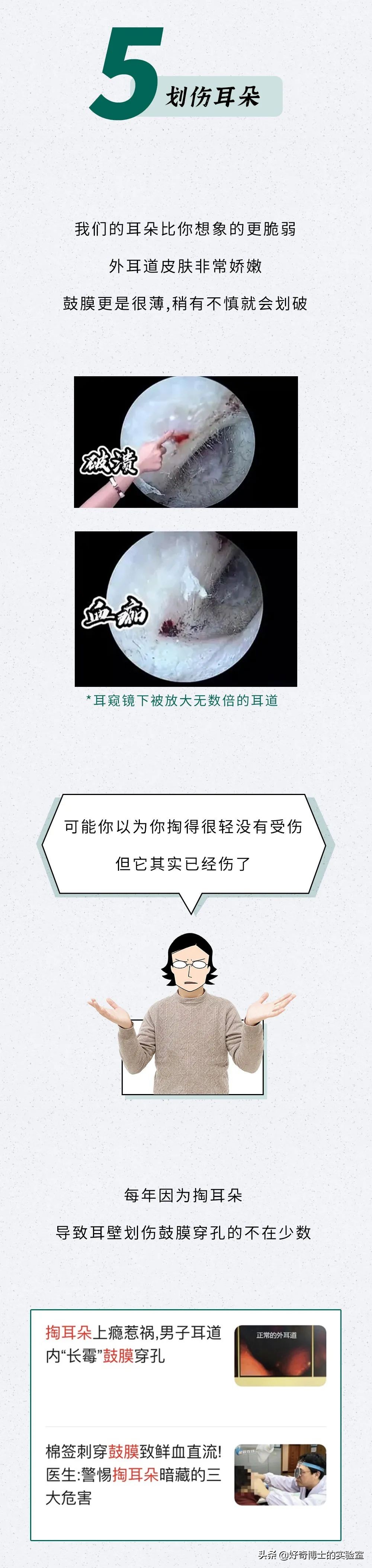 看看8年没有掏耳屎是什么样子,十年不掏耳屎你耳朵有多脏