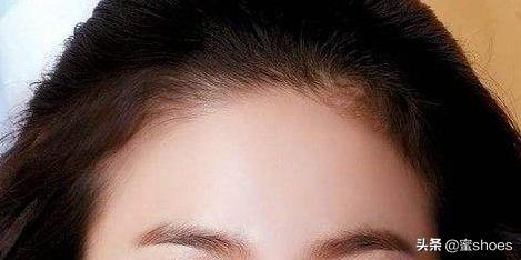 高发际线到底要怎样才能好看,如何弥补发际线太高的缺陷