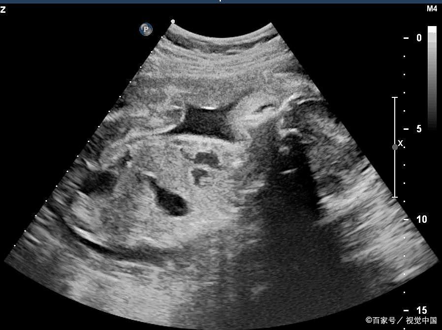 人的生殖生物学练习册,人的生殖课程讲解