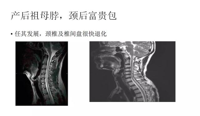 产后恢复少女感,有关产后恢复的图片