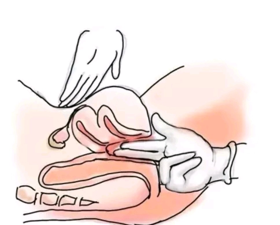 卵巢保养，您以为真能摸到卵巢吗？