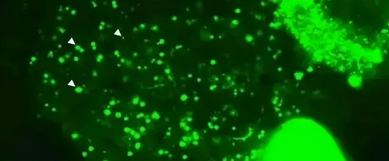 会拉丝的面膜,适合小脸的提拉面膜