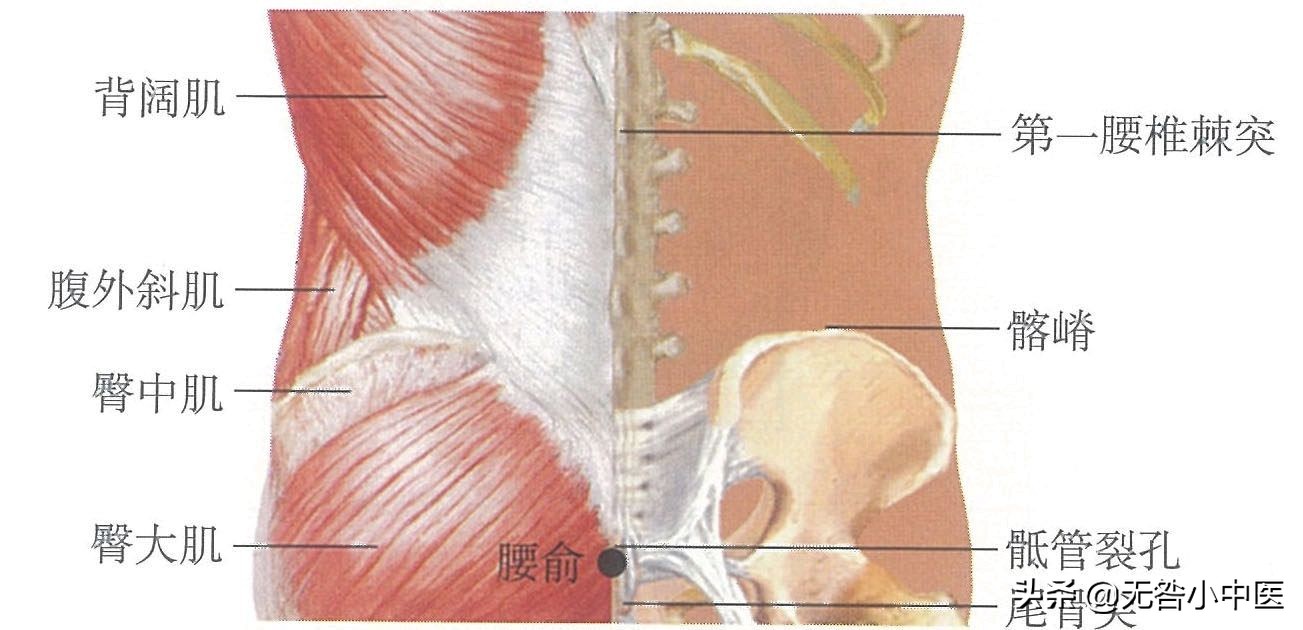 针灸腰部三根大针,针灸治疗腰突三周了