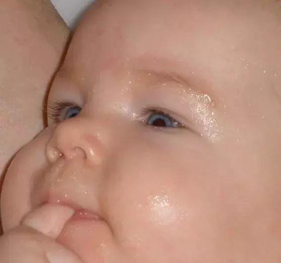 25天新生儿缺钙怎么补,新生儿缺钙