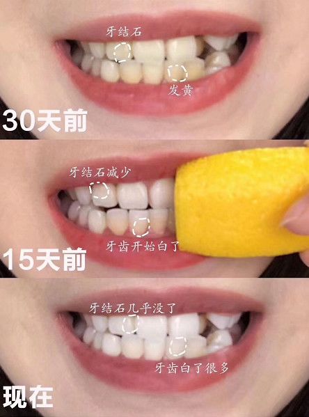 王子文皮肤白吗,王子文美白牙齿的方法