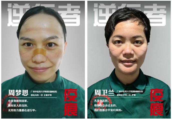 广西中医药大学附属瑞康医院好么,广西中医药大学附属瑞康医院病历