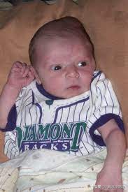 新生儿一些面部正常现象,新生儿出现这五种症状