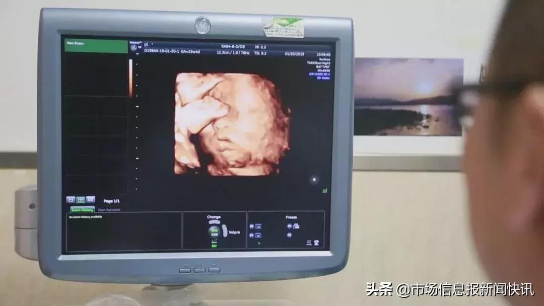 中国首例子宫移植生孩子,中国首例试管婴儿31岁产子