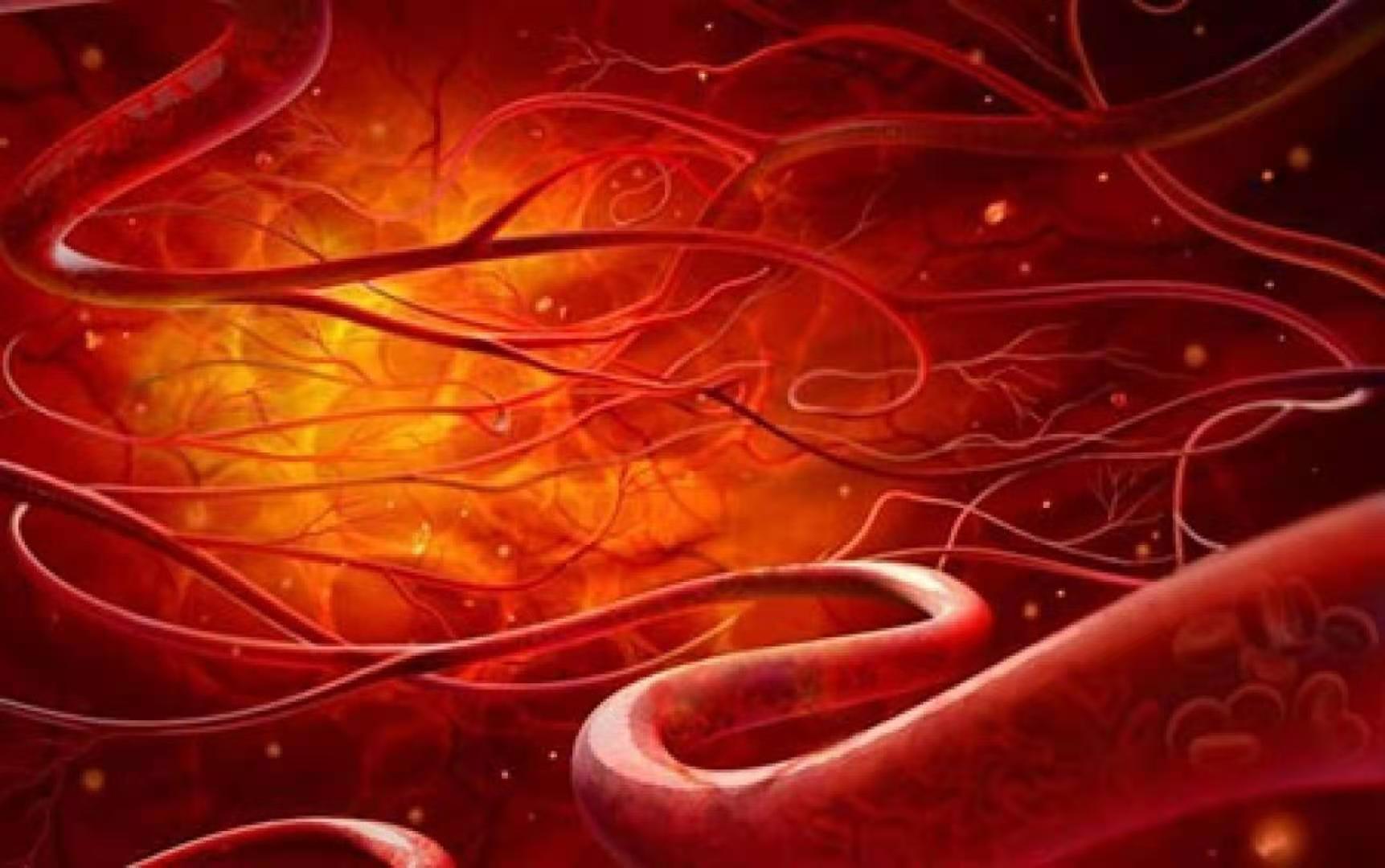 冷凝集素综合征是遗传性的吗,冷凝集素综合征夏季发作吗