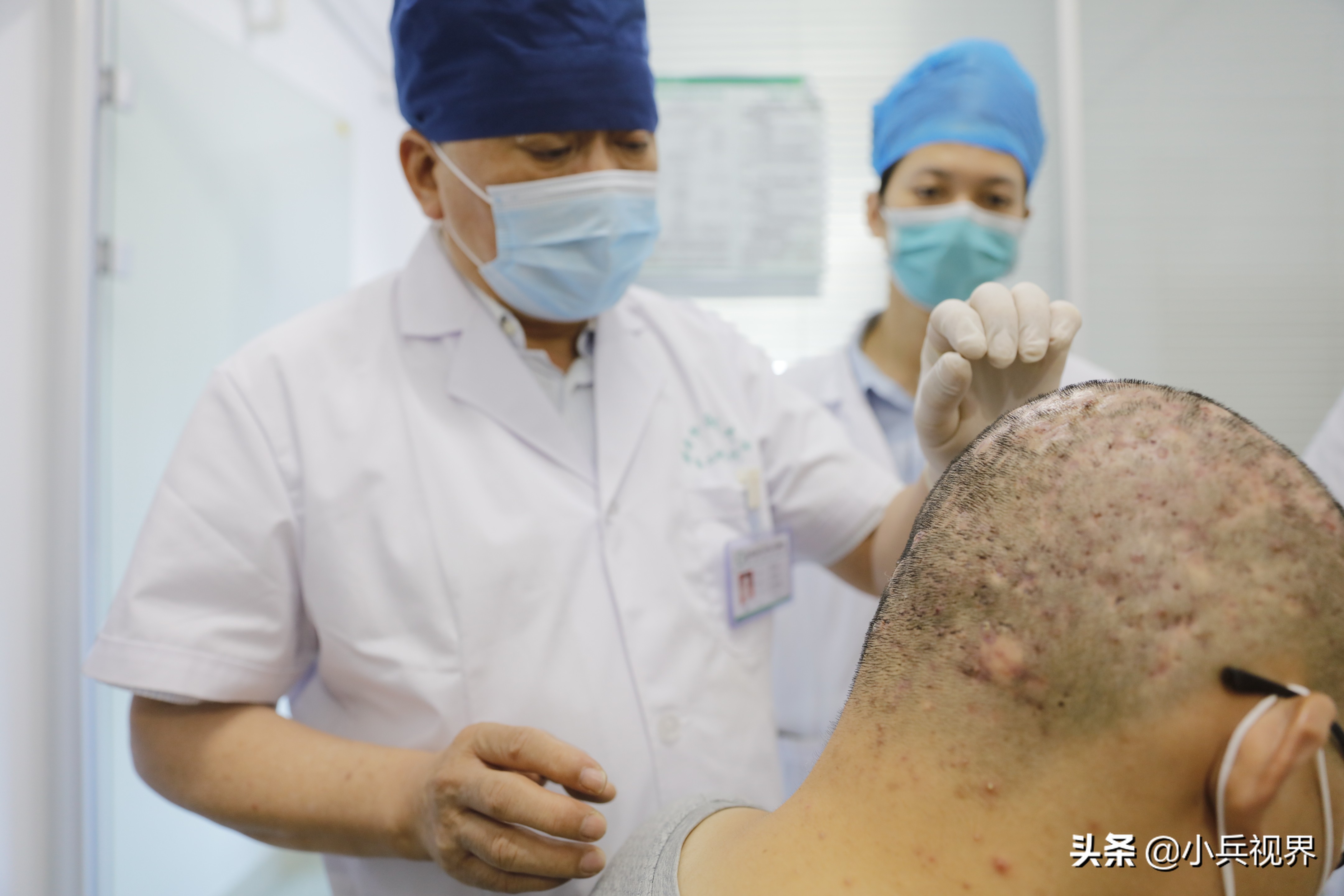 专治皮肤病疑难杂症的老中医,从医40年专治一种病