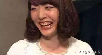 毁灭式的露龈笑也能重获笑容自由,毁灭式