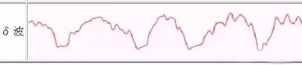 嫩肤脑波,脑波疗愈