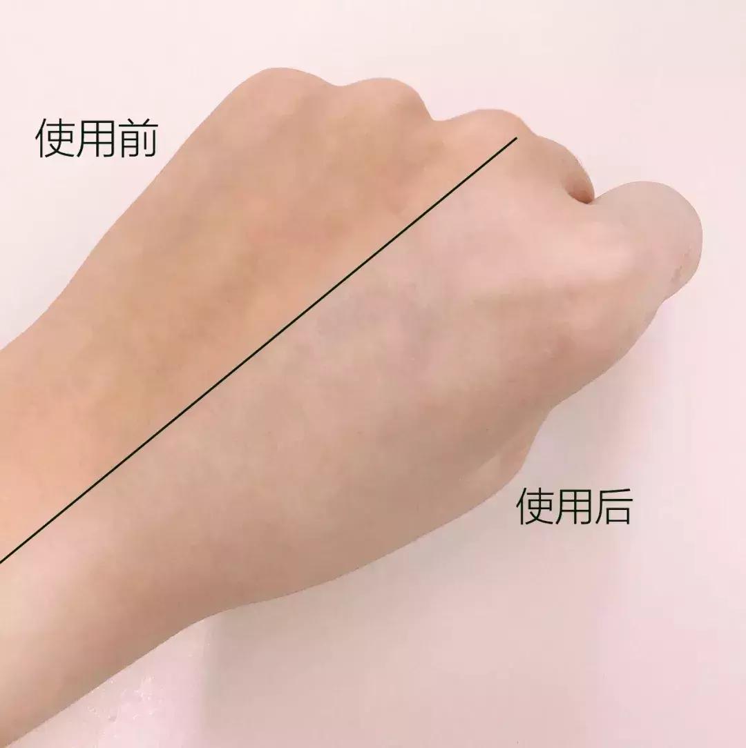 美白通通搞定,什么成分可以持久美白