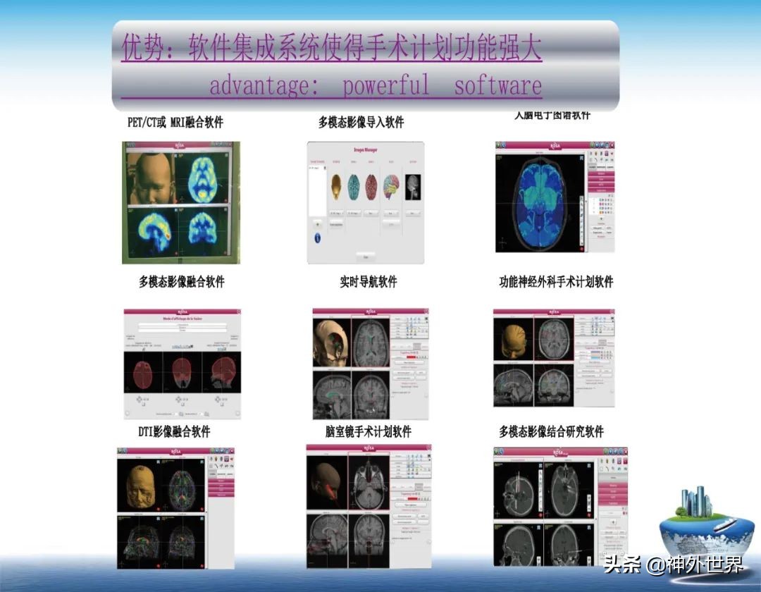 宣武医院神经外科王亚明祖籍,北京宣武医院神经科专家王亚明