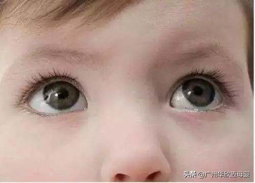 新生儿有眼屎是什么原因怎么护理,新生婴儿眼屎多流泪多怎么办