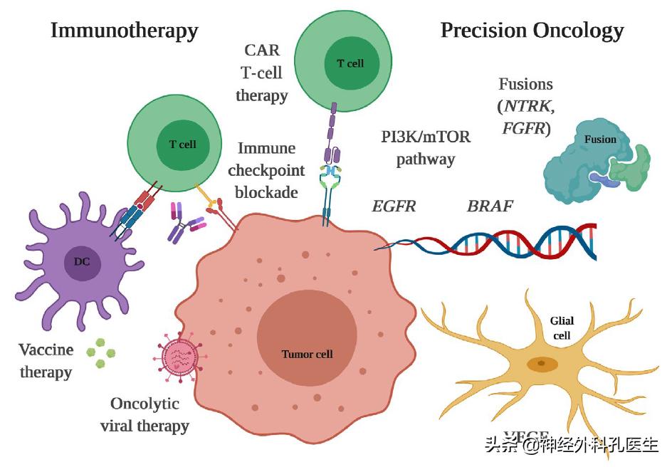 胶质母细胞瘤2024年新药,新诊断胶质母细胞瘤患者生存期