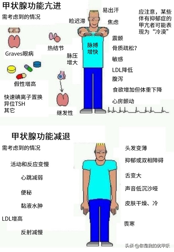 甲状腺回声不均匀促甲状腺激素高,甲状腺彩超甲状腺弥漫性回声改变