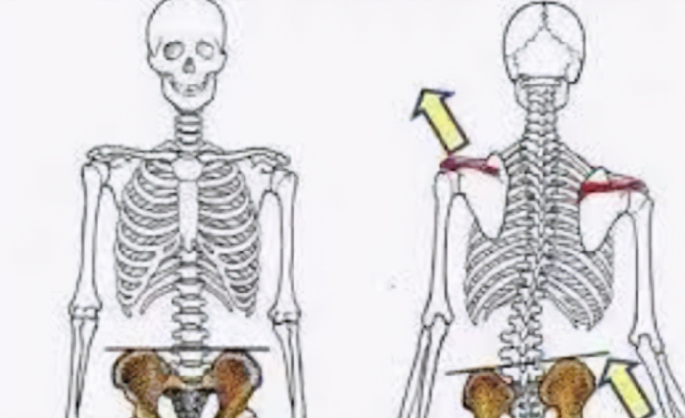 高低肩是怎么造成的该怎么改正,高低肩怎么快速解决