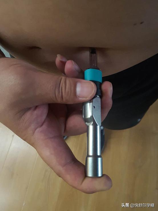 糖尿病注射胰岛素的器械在哪里买,糖尿病胰岛素无针注射器价格表