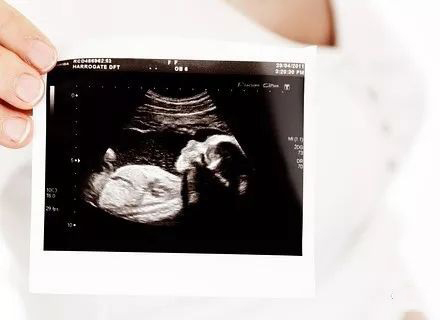 二胎到了预产期还没一点反应,宝宝到了预产期还没反应怎么办