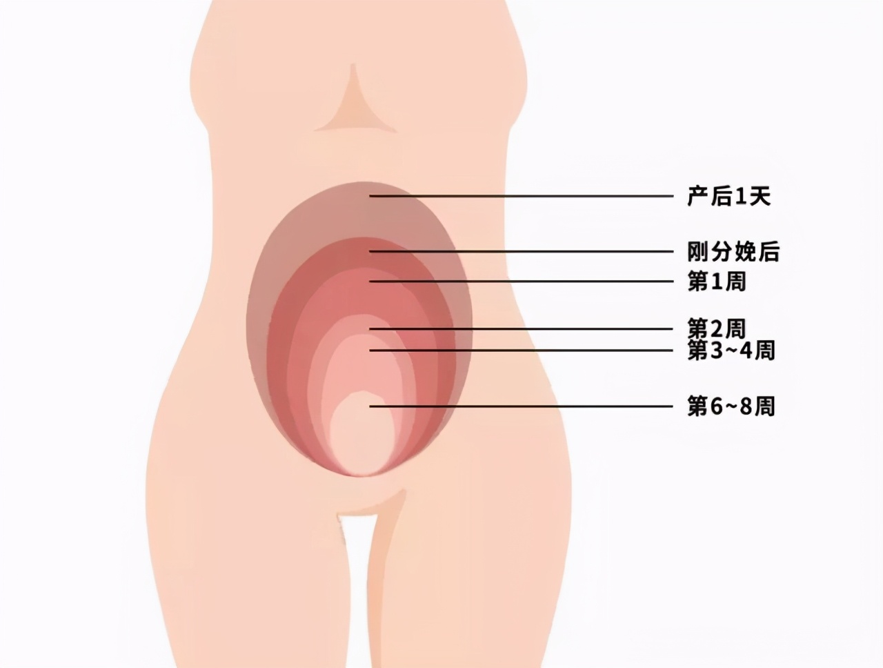 产后肚子瘦不回去的最快方法,产后肚子吸气也缩不回去