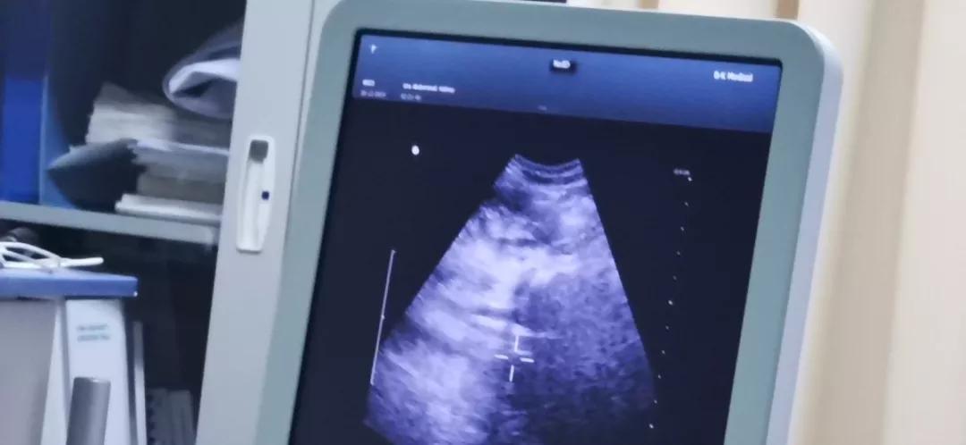 小儿尿道结石如何碎石,小儿尿结石