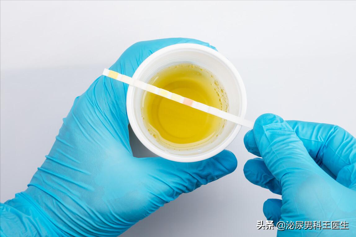 尿酸高身体会出现哪些症状,尿酸高怎么调理下来还需要吃药