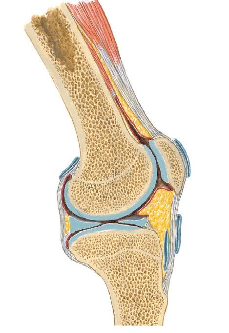 半月板损伤最简单自己鉴别方法,健康之路半月板损伤怎样治疗
