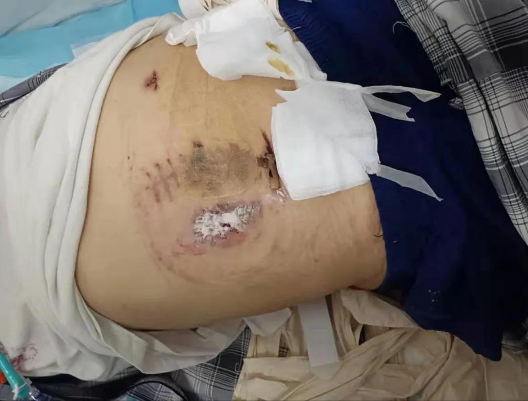 鎮ｇ檶鐖哥埜,鎮ｇ檶鐖朵翰