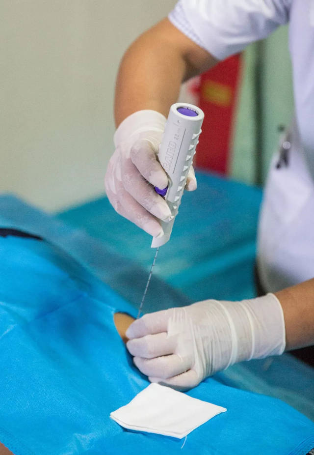 什么是肾穿刺,什么是肾穿刺检查