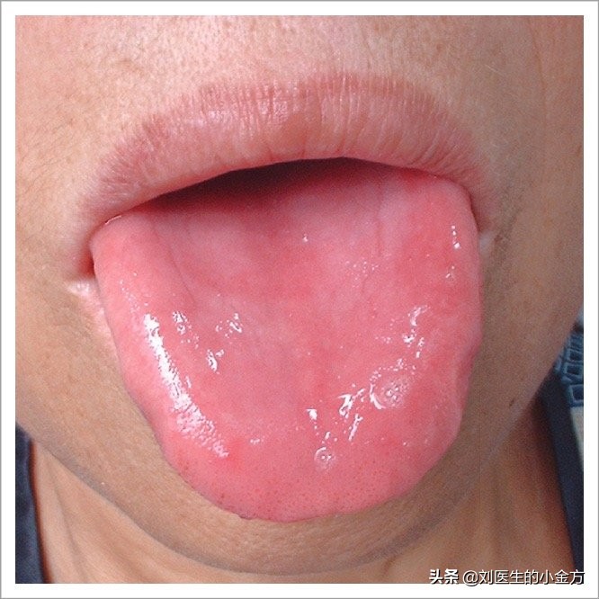 中医舌诊对照表100例,舌诊辨九大体质