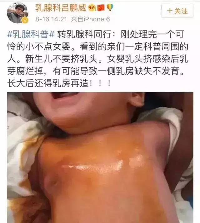 新生宝宝应该吸奶嘴吗,初生儿要挤乳房吗