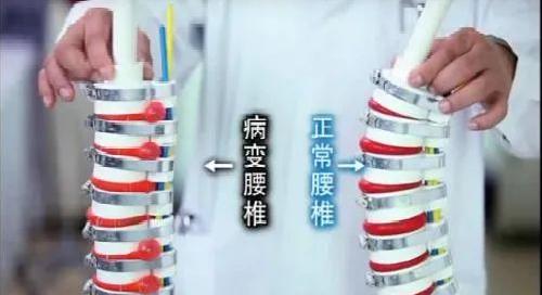 中医正骨咔咔响合集,中医正骨骨头咔咔响的声音