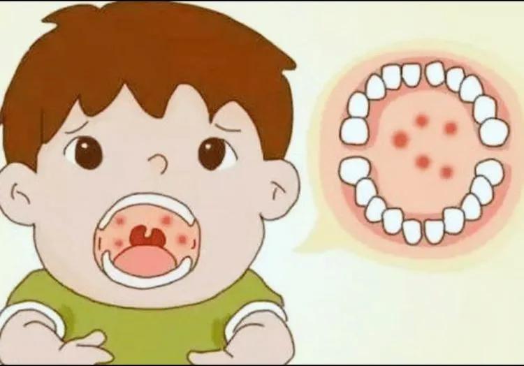 疱疹性咽峡炎是什么原因引起的,疱疹性咽峡炎隔离多久可以上学