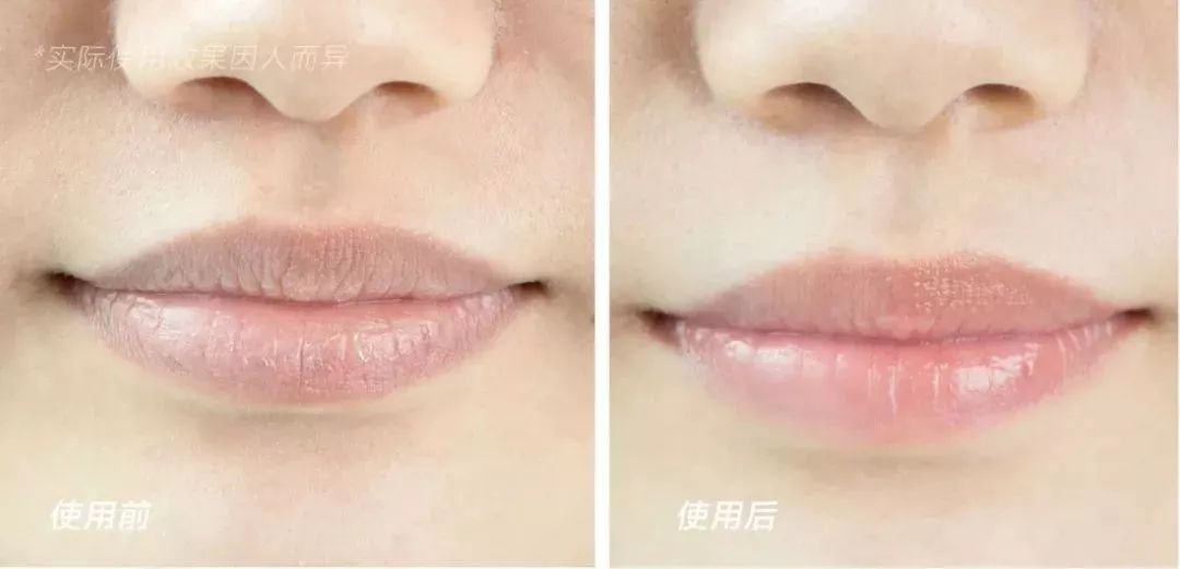 在线等,接吻时咬下女友的死皮,怎么办?