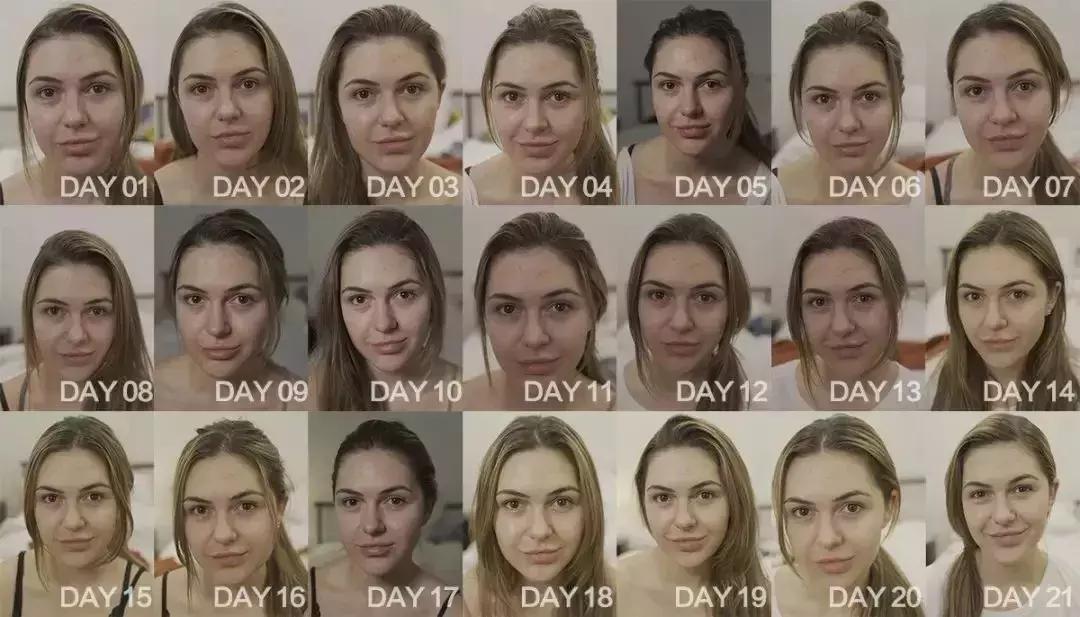 泰国美白针真实事件,女子连续打6年美白针