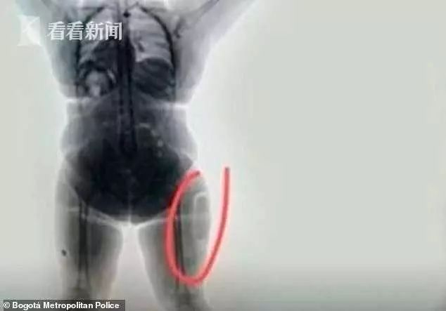 要钱不要命！为了运毒，女子将*品毒**缝进了自己大腿里……