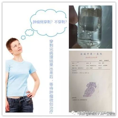 运城市第一医院肿瘤微创及综合介入科，特色技术—肿瘤穿刺活检术