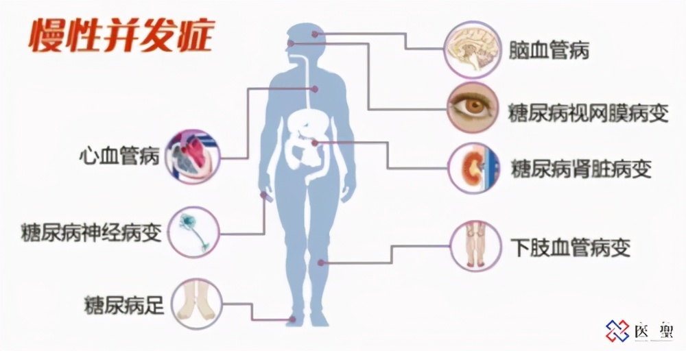 年轻人怎么避免糖尿病并发症,干细胞治疗糖尿病并发症