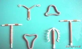 节育环可以终身不取出来吗,节育环能不能永久不取