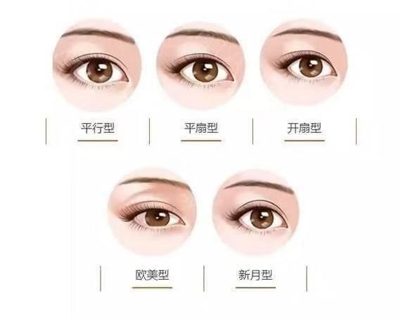 戚薇双眼皮修复视频完整版,戚薇肉条双眼皮是如何恢复的