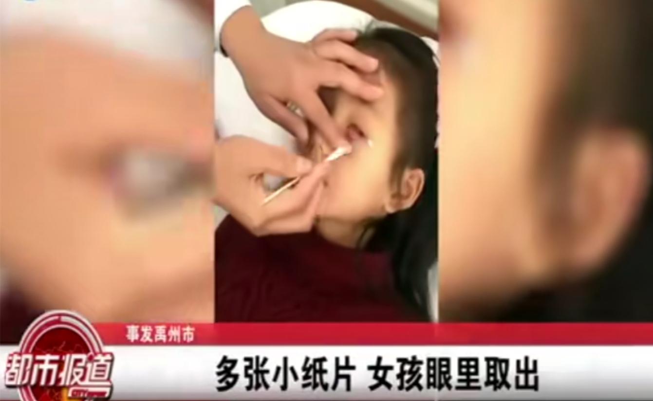 7岁女童眼睛被塞几十张纸纸片,女童眼睛被塞纸片男童已返校