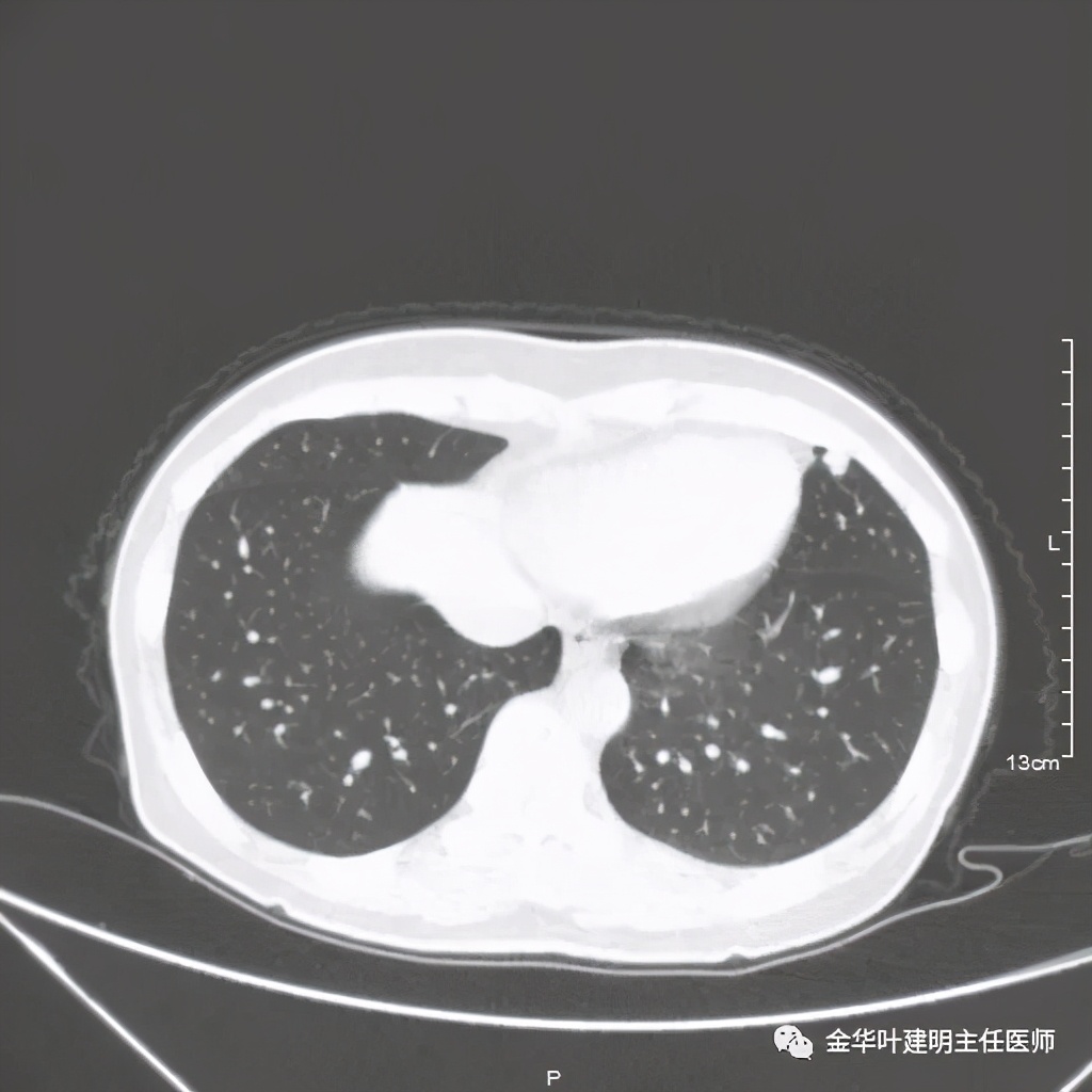 放个大招完整版教学,放个大招完整版前奏