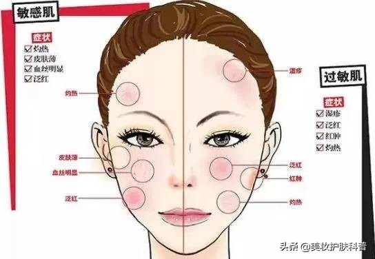 春暖花开过敏症状,春暖花开时预防过敏方法