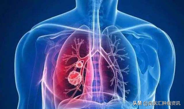 结节息肉囊肿有什么区别,增生结节囊肿息肉哪个更是肿瘤