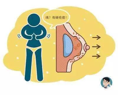 乳腺硬化性腺病易误诊为哪种癌,乳腺包块长得快是什么原因