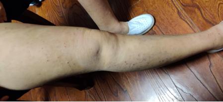 璋﹀窛涓尰,鏉窞璋﹀窛涓尰